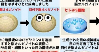 ドイツ人 人工培養した脳にビタミンa与えたら目が生まれてワロタ ほか ひろぶろ