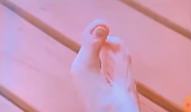 動画】 足の指が２本づつしかない男性が発見される……！！: ひろぶろ